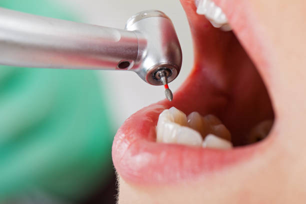 Best Orthodontic Emergency Dentist in Holly Springs, MS